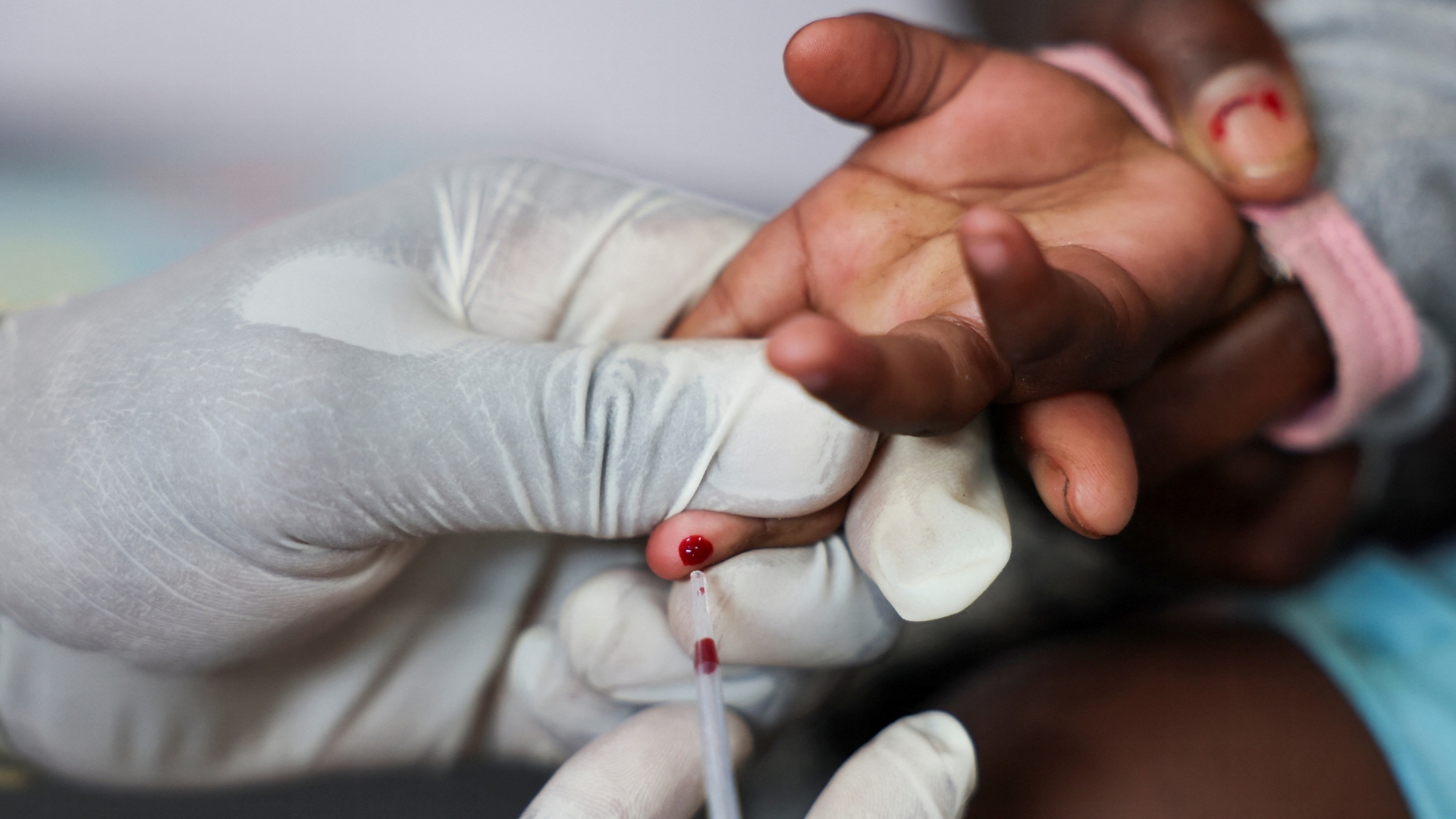 how-can-countries-save-the-lives-of-people-living-with-hiv?
