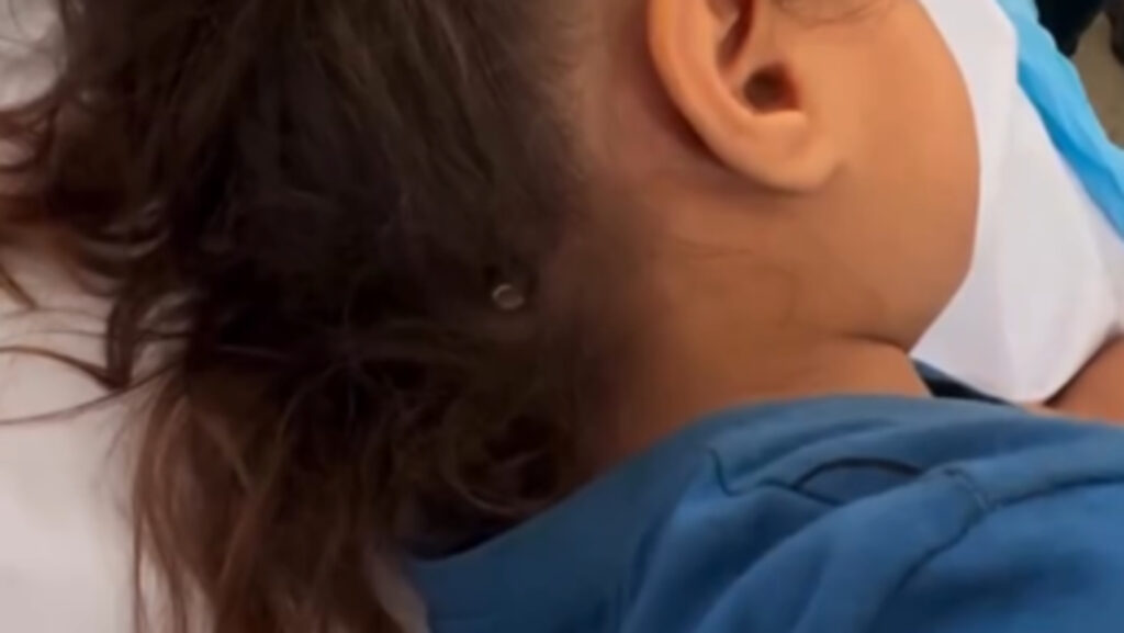 gaza-child-in-hospital-with-israeli-bullet-protruding-from-her-skull