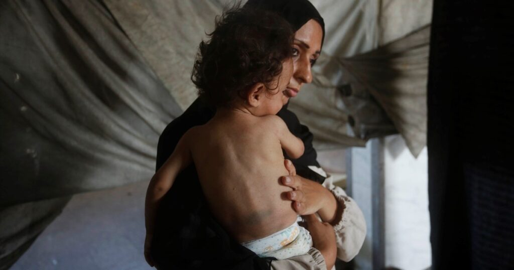 israel’s-starvation-denial-is-an-orwellian-farce