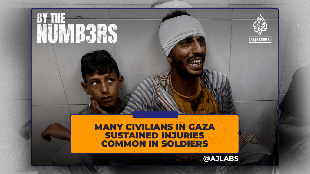 many-civilians-in-gaza-sustained-injuries-common-in-soldiers
