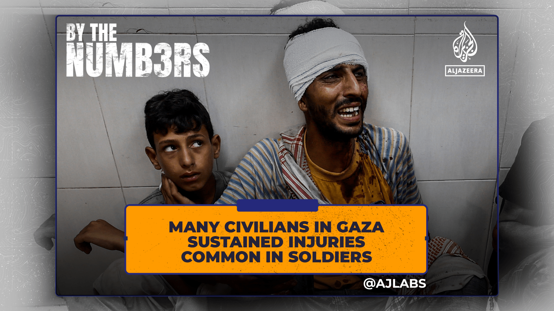 many-civilians-in-gaza-sustained-injuries-common-in-soldiers
