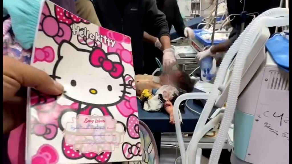 doctors-try-to-save-girl-as-father-was-killed-in-gaza-israeli-attack