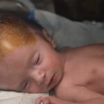 gaza’s-unseen-casualties:-a-surge-in-stillbirths-and-birth-defects